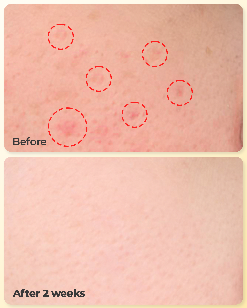 No Redness, No breakouts