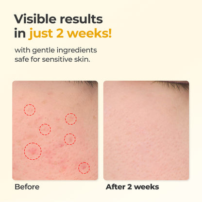 Glutathione Even & Glow First Serum