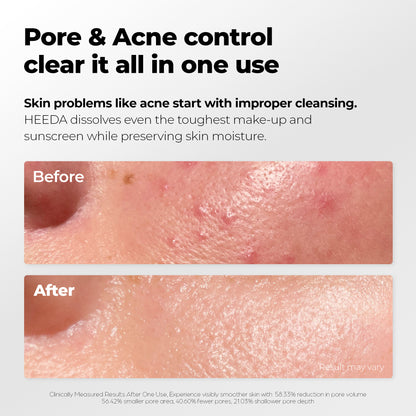 Charcoal Cleansing Duo Bundle